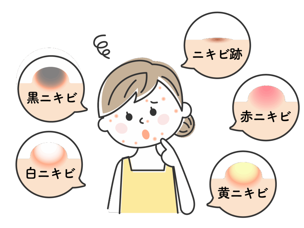 にきび